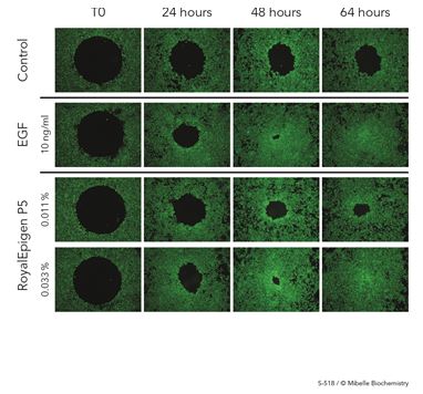 epigenetica