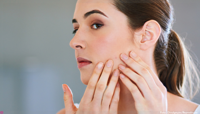 Estudo identifica novo fator genético determinante para acne